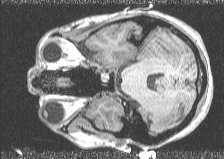 [Top view of human MRI slice]