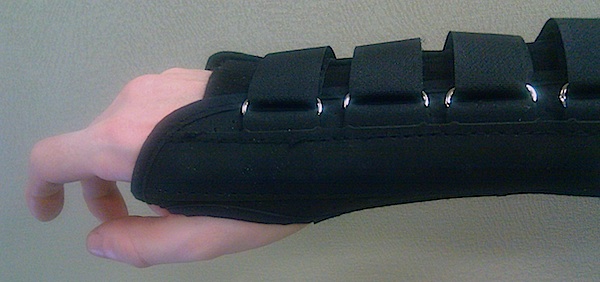 [Splint on wrist]